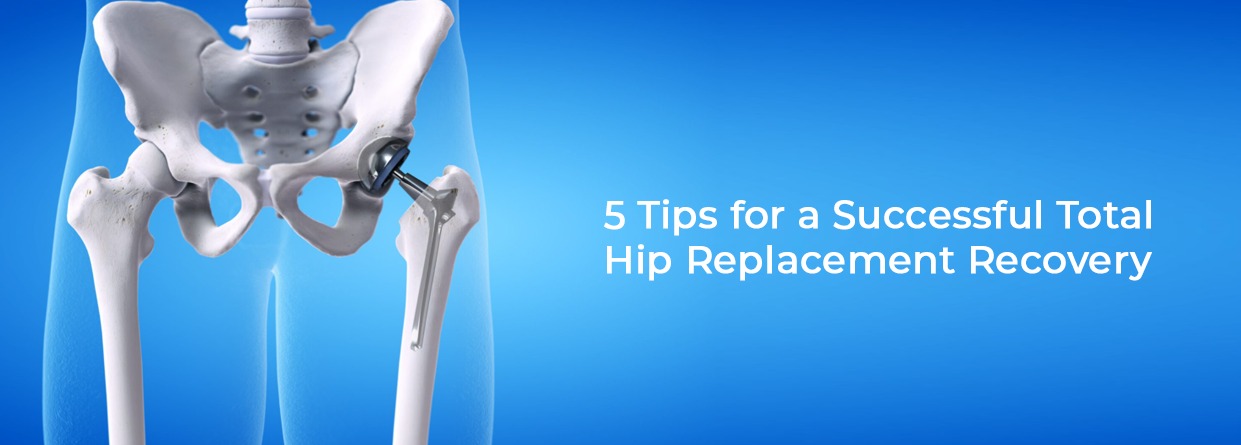 5 Tips for a Successful Total Hip Replacement Recovery